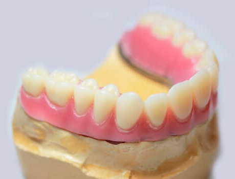 prótesis dentales fijas y removibles